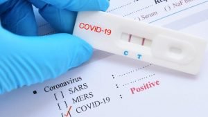 Türk Mühendislerin Covid-19 Teşhisini Yarım Saate Düşüren PCR Tanı Kitine Dünyadan Yoğun İlgi