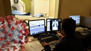 Koronavirüsü Tespit Eden Yapay Zeka Geliştirildi